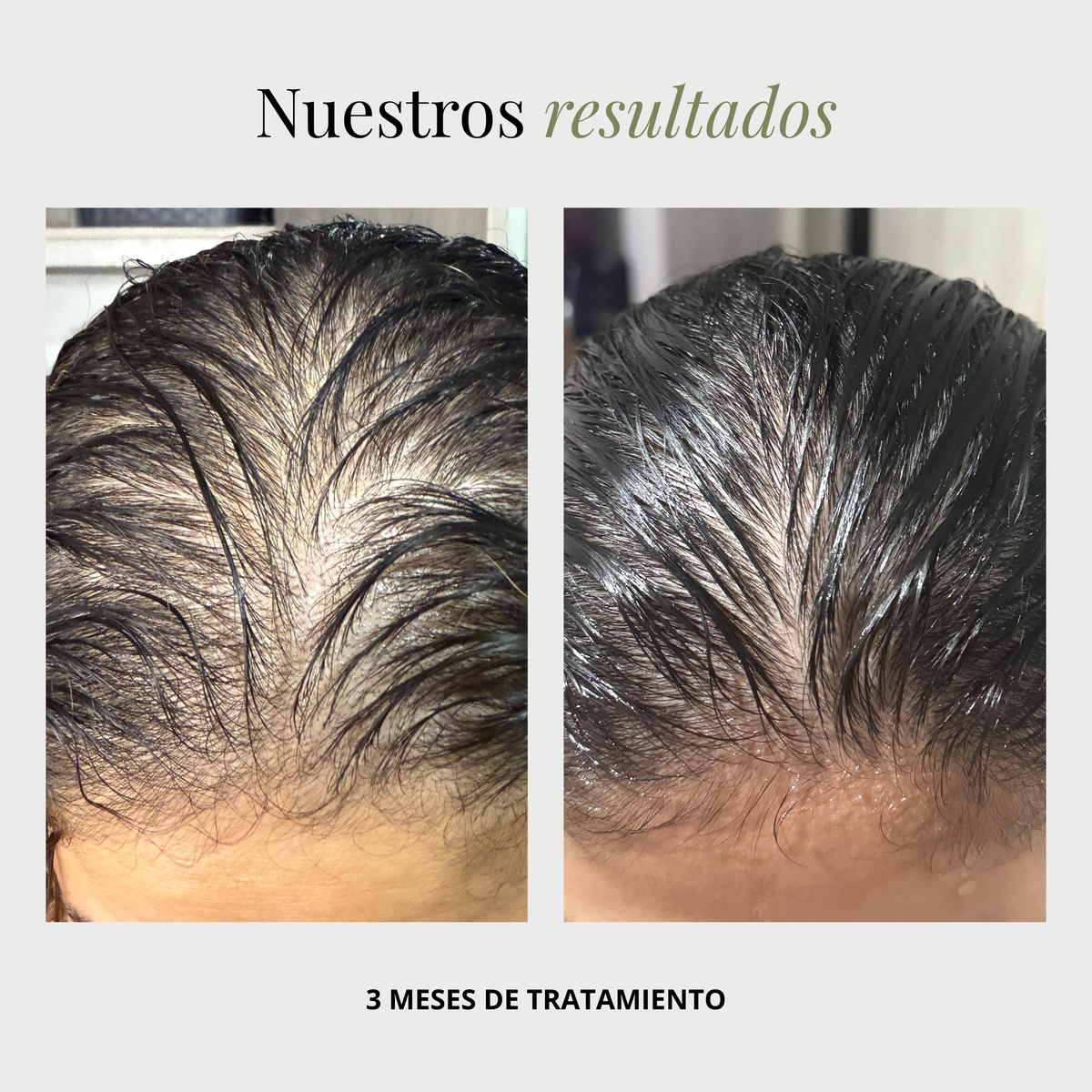 BUNDU Hair | 3 Pack